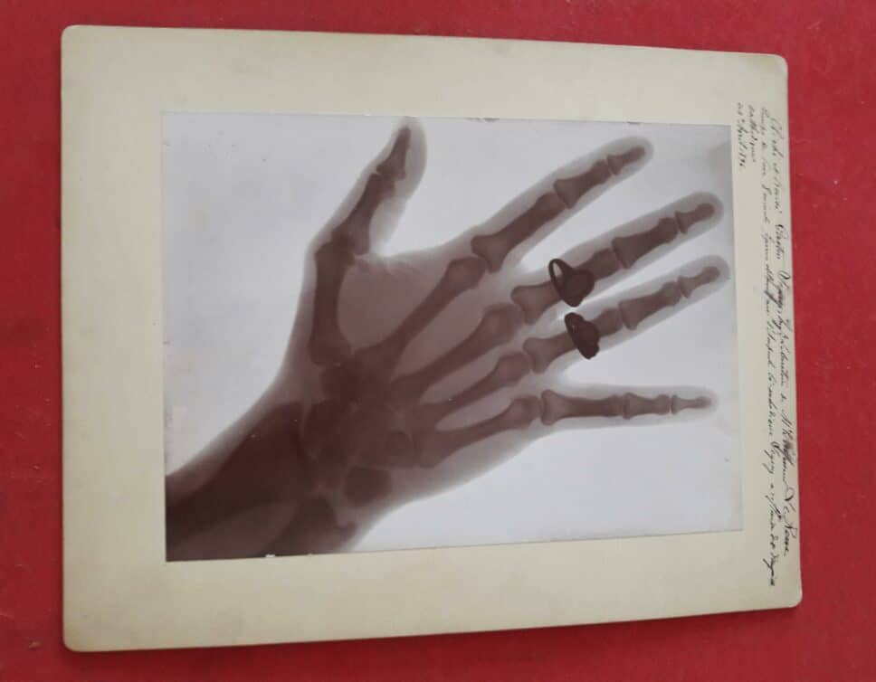 Estimation Livre, manuscrit: radiographie de la main